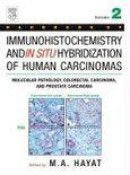 Handbook Of Immunohistochemistry And In Situ Hybridization Of Human Carcinomas