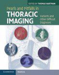 Pearls and Pitfalls in Thoracic Imaging 1