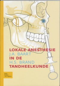 Lokale anesthesie in de tandheelkunde