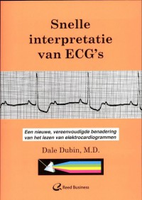 Snelle interpretatie van ECG's