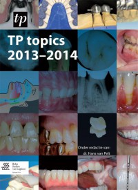 TP topics 2013-2014
